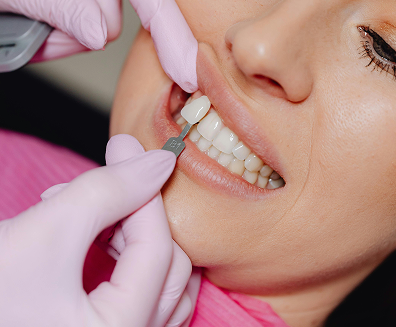 Cosmetic dentistry patient with a whitened, refined smile