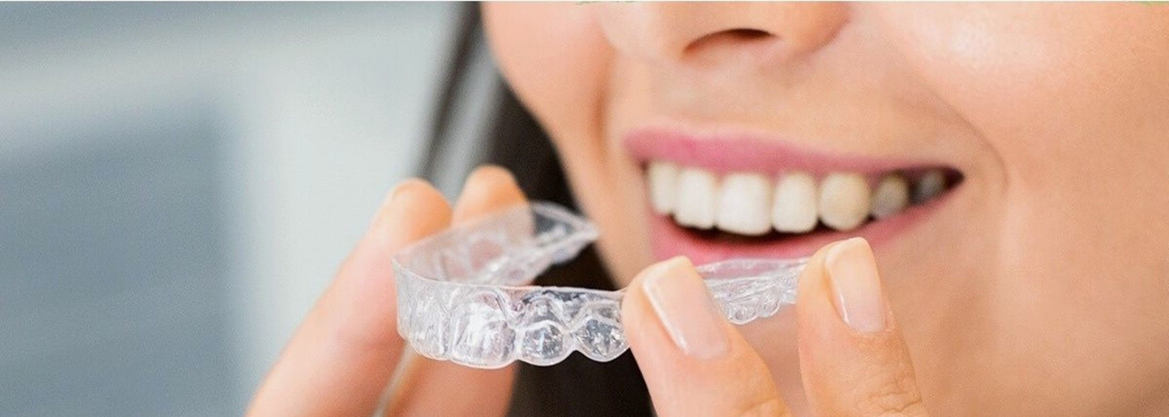 Dentist fitting a custom mouthguard